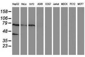 Image no. 1 for anti-Ankyrin Repeat Domain 53 (ANKRD53) (AA 1-300) antibody (ABIN1490720) (ANKRD53 Antikörper  (AA 1-300))