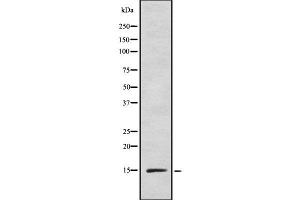 Western blot analysis INSL5 using HeLa whole cell lysates (INSL5 Antikörper)