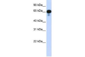 WB Suggested Anti-PPM1J Antibody Titration: 0.