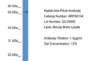 Western Blotting (WB) image for anti-Protein Kinase C, eta (PRKCH) (C-Term) antibody (ABIN785834) (PKC eta Antikörper  (C-Term))