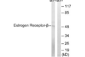 Western blot analysis of extracts from MCF-7 cells, using Estrogen Receptor-β (Ab-87) antibody. (ESR2 Antikörper  (Ser87))