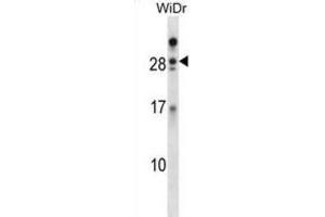 Western Blotting (WB) image for anti-Azurocidin 1 (AZU1) antibody (ABIN2998391) (Azurocidin Antikörper)