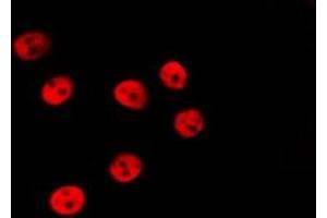 ABIN6277204 staining HepG2 by IF/ICC. (Histone 3 Antikörper  (H3K79me))