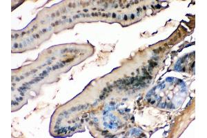 Immunohistochemistry (IHC) image for anti-Fatty Acid Binding Protein 1, Liver (FABP1) (AA 6-36), (N-Term) antibody (ABIN3042384)