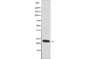 Western blot analysis of extracts from HeLa cells, using RPL17 antibody. (RPL17 Antikörper  (C-Term))