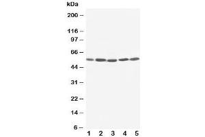 Western blot testing of KIM-1 antibody and Lane 1:  SMMC-7721;  2: HeLa;  3: PANC;  4: M231;  5: M453 cell lysate. (HAVCR1 Antikörper  (C-Term))