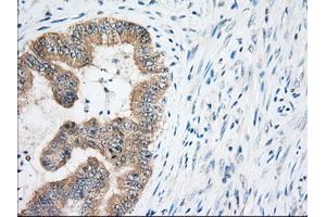 Immunohistochemical staining of paraffin-embedded Human Kidney tissue using anti-EIF2S1 mouse monoclonal antibody. (EIF2S1 Antikörper)