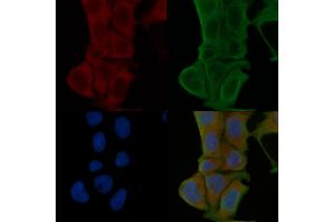 ABIN6264741 and ABIN6274043 staining Hela cells(24h of starvation treatment) by IF/ICC. (RhoA,B,C (C-Term) Antikörper)