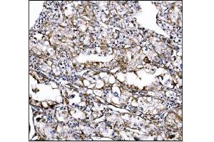 IHC analysis of DLGAP1 using anti-DLGAP1 antibody (ABIN7600257).
