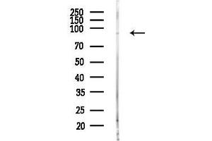 anti-Feline Sarcoma Oncogene (FES) (C-Term) antibody