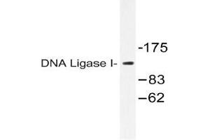 Western blot (WB) analysis of DNA Ligase I antibody in extracts from HT-29 cells. (LIG1 Antikörper)