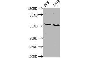 Western Blot Positive WB detected in: PC-3 whole cell lysate, A549 whole cell lysate All lanes: ETV5 antibody at 4. (ETV5 Antikörper  (AA 124-265))