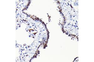 Immunohistochemistry of paraffin-embedded rat lung using RGS14 Rabbit pAb (ABIN6130669, ABIN6146917, ABIN6146918 and ABIN6225301) at dilution of 1:100 (40x lens). (RGS14 Antikörper  (AA 230-510))