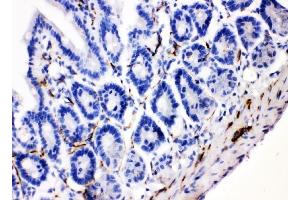 IHC analysis of VIP using anti-VIP antibody (ABIN4886760). (Vip Antikörper  (Middle Region))