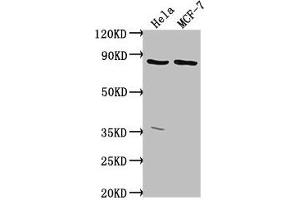 Western Blot Positive WB detected in: Hela whole cell lysate, MCF-7 whole cell lysate All lanes: TTC39B antibody at 1:2000 Secondary Goat polyclonal to rabbit IgG at 1/50000 dilution Predicted band size: 77, 67, 76, 60, 70, 23 kDa Observed band size: 77 kDa (TTC39B Antikörper  (AA 10-122))