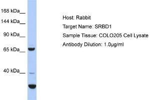 Host: Rabbit Target Name: SRBD1 Sample Type: COLO205 Whole Cell lysates Antibody Dilution: 1. (SRBD1 Antikörper  (C-Term))