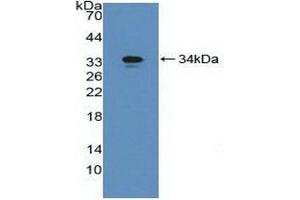 Detection of Recombinant gGT1, Mouse using Polyclonal Antibody to Gamma-Glutamyltransferase 1 (gGT1) (GGT1 Antikörper  (AA 296-537))