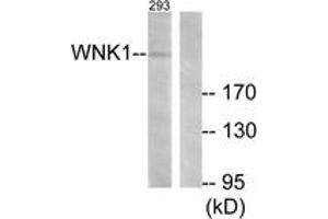 Western blot analysis of extracts from 293 cells, treated with EGF 200ng/ml 30', using WNK1 (Ab-58) Antibody.