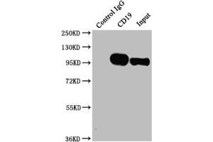 Immunoprecipitating CD19 in Raji whole cell lysate Lane 1: Rabbit control IgG instead of ABIN7127396 in Raji whole cell lysate. (Rekombinanter CD19 Antikörper)