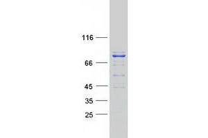 Validation with Western Blot (DGKA Protein (Transcript Variant 4) (Myc-DYKDDDDK Tag))