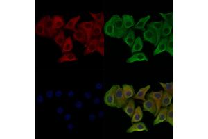 Phospho-p23 (Ser113) Antibody staining Hela cells(heat shock treatment) by IF/ICC. (CDK5R1 Antikörper  (pSer113))
