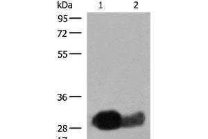 Western blot analysis of Raji cell Human spleen tissue lysates using HLA-DRB1 Polyclonal Antibody at dilution of 1:550 (HLA-DRB1 Antikörper)