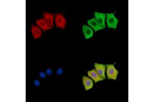 GK5 Antibody staining Hela cells by IF/ICC. (GK5 Antikörper)