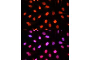 Immunofluorescence (IF) image for anti-NOP2/Sun Domain Family, Member 2 (NSUN2) (AA 508-767) antibody (ABIN1681117)