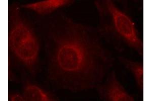 Immunofluorescence staining of methanol-fixed Hela cells using AKT1/AKT2/AKT3(phospho-Tyr315/316/312) Antibody. (AKT 1/2/3 Antikörper  (pTyr312, pTyr315, pTyr316))