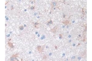 Immunohistochemistry (IHC) image for anti-Matrix Metallopeptidase 3 (Stromelysin 1, Progelatinase) (MMP3) (AA 363-477) antibody (ABIN7427837)