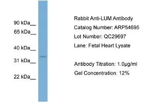 WB Suggested Anti-LUM  Antibody Titration: 0. (LUM Antikörper  (Middle Region))