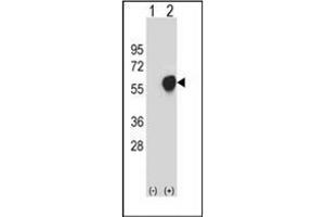 Western blot analysis of PDHA1 (arrow) using PDHA1 Antibody . (PDHA1 Antikörper)