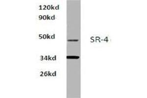 Western blot analysis of SR-4 Antibody  in extracts from Hela cells at 1/500 dilution. (Serotonin Receptor 4 Antikörper)