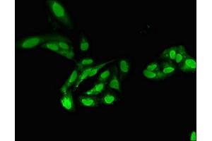 Immunofluorescent analysis of Hela cells using ABIN7169266 at dilution of 1:100 and Alexa Fluor 488-congugated AffiniPure Goat Anti-Rabbit IgG(H+L) (PPP2CA Antikörper  (Catalytic Subunit alpha))