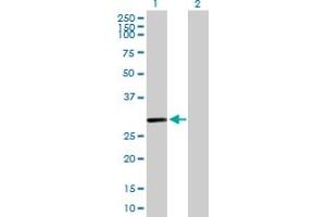 Western Blot analysis of C10orf63 expression in transfected 293T cell line by C10orf63 MaxPab polyclonal antibody. (ENKUR Antikörper  (AA 1-256))