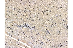 ABIN7096150 and ABIN7100212 at 1/100 staining rat muscle tissue by IHC-P. (ABRA Antikörper)