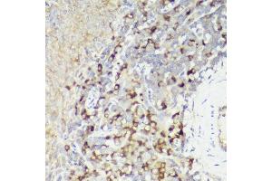 Immunohistochemistry of paraffin-embedded rat spleen using IL18 antibody (ABIN7267992) at dilution of 1:50 (40x lens). (IL-18 Antikörper)