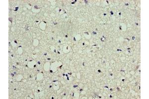 Immunohistochemistry of paraffin-embedded human brain tissue using ABIN7174208 at dilution of 1:100