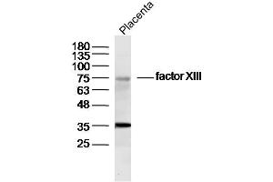 Mouse placenta lysates probed with factor XIII Polyclonal Antibody, Unconjugated  at 1:300 dilution and 4˚C overnight incubation. (Factor XIII Antikörper  (AA 331-732))