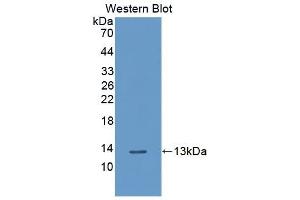 Detection of Recombinant PLXNB1, Human using Polyclonal Antibody to Plexin B1 (PLXNB1) (PLXNB1 Antikörper  (AA 200-727))