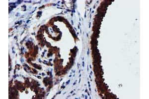 Immunohistochemical staining of paraffin-embedded Human breast tissue using anti-EPN2 mouse monoclonal antibody. (Epsin 2 Antikörper)