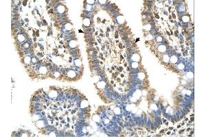 Complement C8b antibody was used for immunohistochemistry at a concentration of 4-8 ug/ml. (C8B Antikörper  (Middle Region))