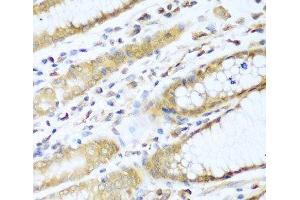 Immunohistochemistry of paraffin-embedded Human stomach using UBE2L3 Polyclonal Antibody at dilution of 1:100 (40x lens). (UBE2L3 Antikörper)