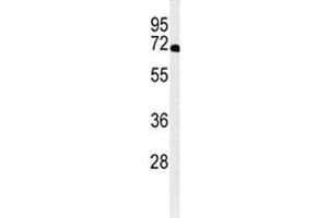 Western blot analysis of XRCC6 antibody and A2058 lysate. (XRCC6 Antikörper  (AA 521-548))