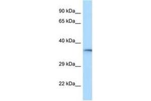 HVCN1 Antikörper  (C-Term)