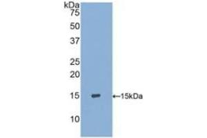 Detection of Recombinant S100A9, Human using Polyclonal Antibody to S100 Calcium Binding Protein A9 (S100A9) (S100A9 Antikörper  (AA 1-114))
