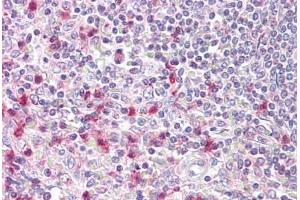Anti-NFAT5 antibody IHC staining of human spleen. (NFAT5 Antikörper  (AA 1171-1220))
