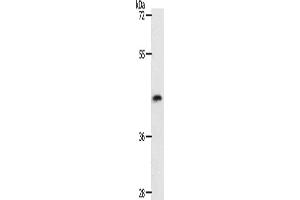 Western Blotting (WB) image for anti-Plasminogen Activator, Tissue (PLAT) antibody (ABIN2426913) (PLAT Antikörper)