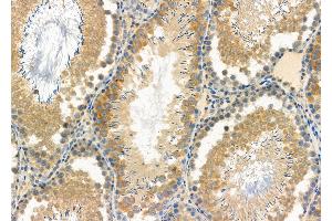 ABIN6261885 and ABIN6277125 at 1/100 staining Rat testis tissue by IHC-P. (GAS2L1 Antikörper  (C-Term))