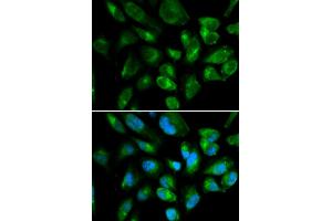 Immunofluorescence analysis of HepG2 cells using KIR2DL3 antibody (ABIN3212244).
